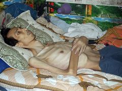 陈建中被劳教所通知亲人接回时体重仅剩七十多斤，骨瘦如柴