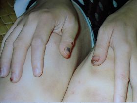 二零零四年，郭照青在桃江县看守所被邪<span