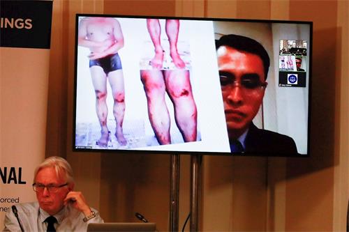 '图2:二零一九年四月六日,法轮功学员于溟通过视频连线向“独立人民法庭/中国法庭”作证,并提供的图片和视频证据曝光中共罪行。(本图片来源:endtransplantabuse.org)'