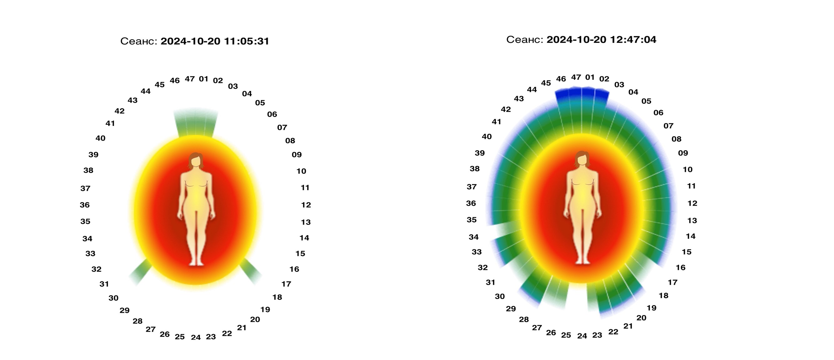 图7:展会上有一个展台能拍摄到人体周围的场,图为法轮大法修炼者在炼功前(左)和炼功后(右)的不同能量场的照片。